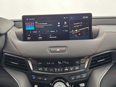 2025 Acura TLX A-Spec